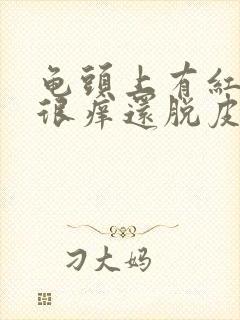 龟头上有红点 很痒还脱皮