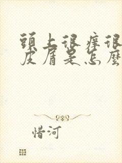 头上很痒很多头皮屑是怎么回事封面