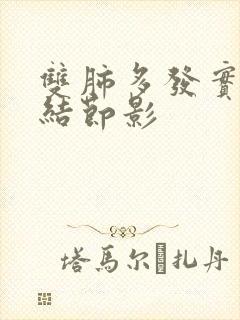 双肺多发实性微结节影