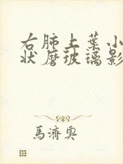 右肺上叶小结节状磨玻璃影