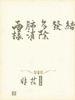 两肺多发结节怎样消除封面