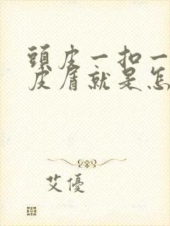 头皮一扣一块头皮屑就是怎么回事