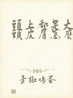 头上都是大块干头皮屑怎么治封面