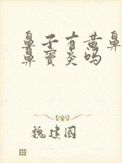 鼻子有黄鼻涕是鼻窦炎吗