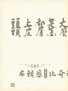 头上都是大块干头皮屑怎么治封面