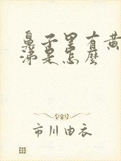 鼻子里有黄脓鼻涕是怎么