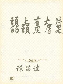 头上有大片白色的头皮屑是什么原因