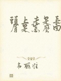 头上老是长头皮屑是怎么回事怎么治