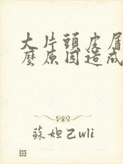 大片头皮屑是什么原因造成的