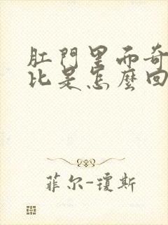 肛门里面奇痒无比是怎么回事