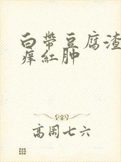 白带豆腐渣外阴痒红肿