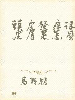 头皮发痒很多头皮屑是怎么回事,怎么解决