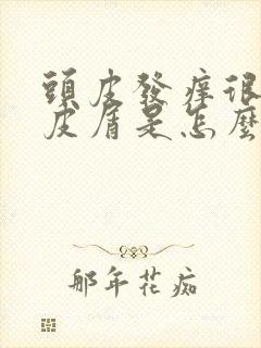 头皮发痒很多头皮屑是怎么回事,怎么解决