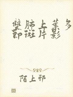 双肺上叶多发结节斑片影