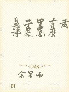 鼻子里有黄脓鼻涕是怎么