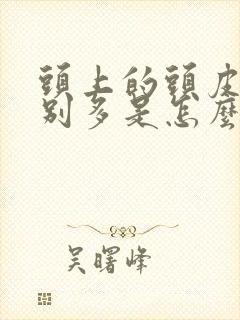 头上的头皮屑特别多是怎么回事