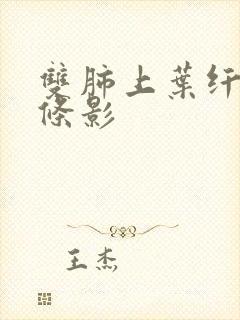 双肺上叶纤维索条影