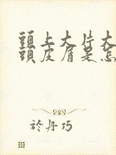 头上大片大片的头皮屑是怎么回事