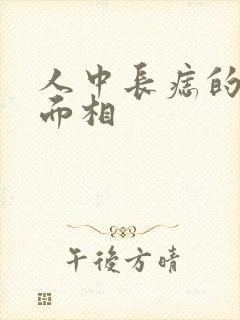 人中长痣的女人面相封面