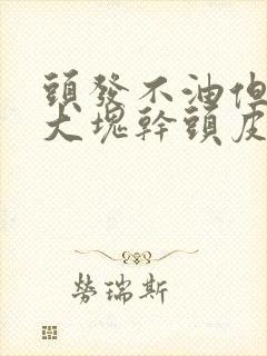 头发不油但是有大块干头皮屑