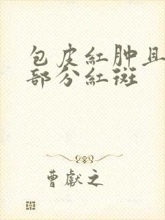 包皮红肿且龟头部分红斑