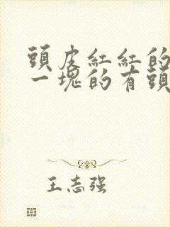 头皮红红的一块一块的有头皮屑