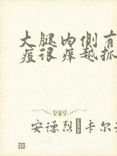 大腿内侧有小痘痘很痒越抓越痒