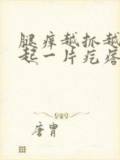 腿痒越抓越痒还起一片疙瘩封面