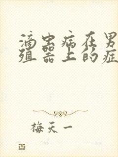 滴虫病在男性生殖器上的症状有哪些