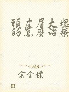 头皮屑大块大块的怎么治疗封面