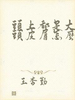 头上都是大块干头皮屑怎么治