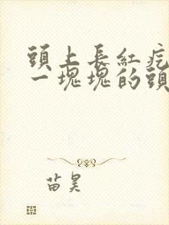 头上长红疙瘩痒一块块的头皮屑封面