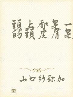 头上都是一块块的头皮屑是怎么回事