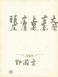 头皮上有大块头皮屑是怎么回事啊