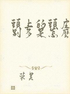 头上的头皮屑特别多是怎么回事