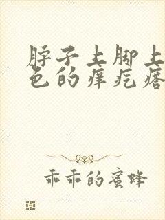 脖子上脚上起红色的痒疙瘩