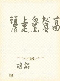 头上忽然有头皮屑是怎么回事