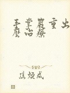 手掌严重出汗怎么治疗封面