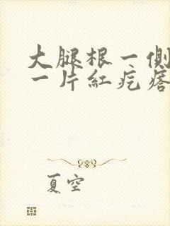 大腿根一侧起了一片红疙瘩很痒封面