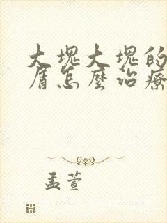 大块大块的头皮屑怎么治疗