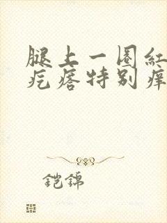 腿上一圈红色的疙瘩特别痒