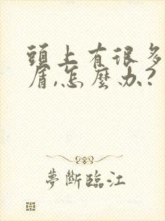 头上有很多头皮屑,怎么办?封面