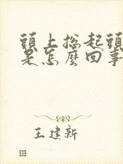 头上总起头皮屑是怎么回事