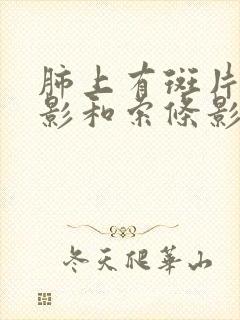 肺上有斑片结节影和索条影