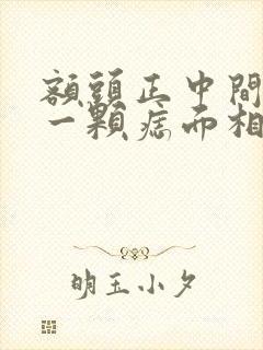 额头正中间长了一颗痣面相