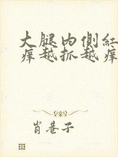 大腿内侧红斑痒痒越抓越痒