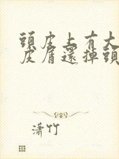 头皮上有大块头皮屑还掉头发