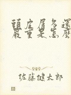 头皮屑多还掉发严重是怎么回事