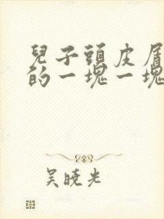 儿子头皮屑白白的一块一块的是什么