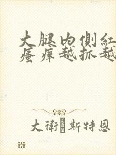 大腿内侧红疙瘩瘙痒越抓越多